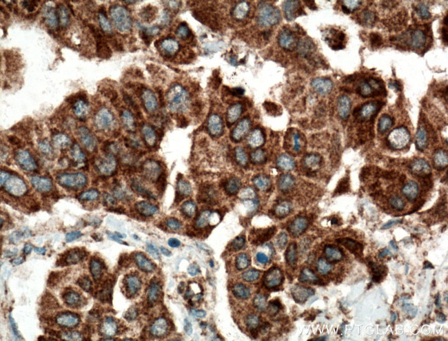 SMYD3 Antibody in Immunohistochemistry (Paraffin) (IHC (P))