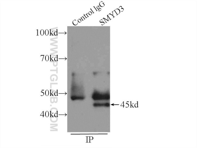 SMYD3 Antibody in Immunoprecipitation (IP)