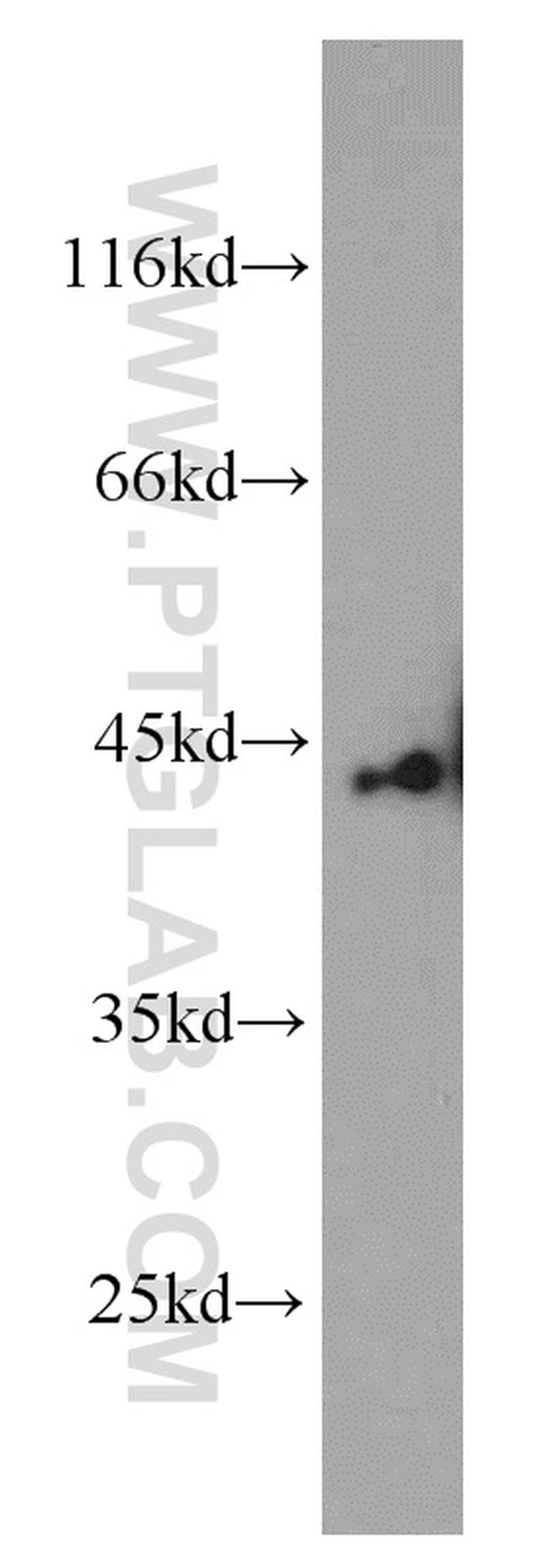 SMYD3 Antibody in Western Blot (WB)