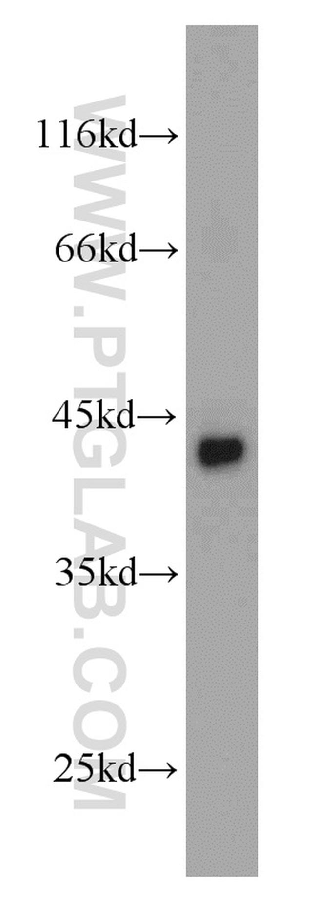 SMYD3 Antibody in Western Blot (WB)