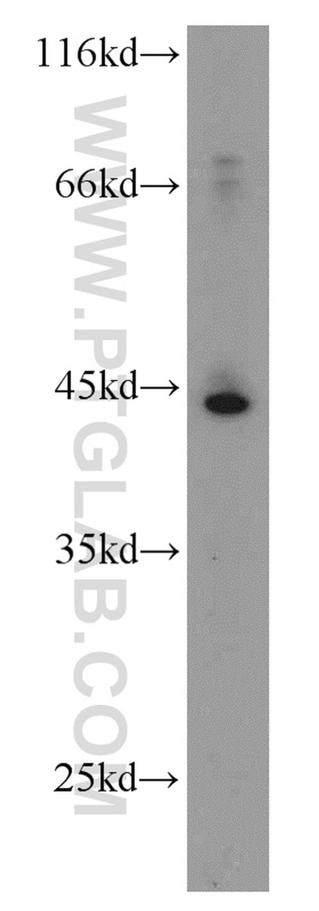 SMYD3 Antibody in Western Blot (WB)