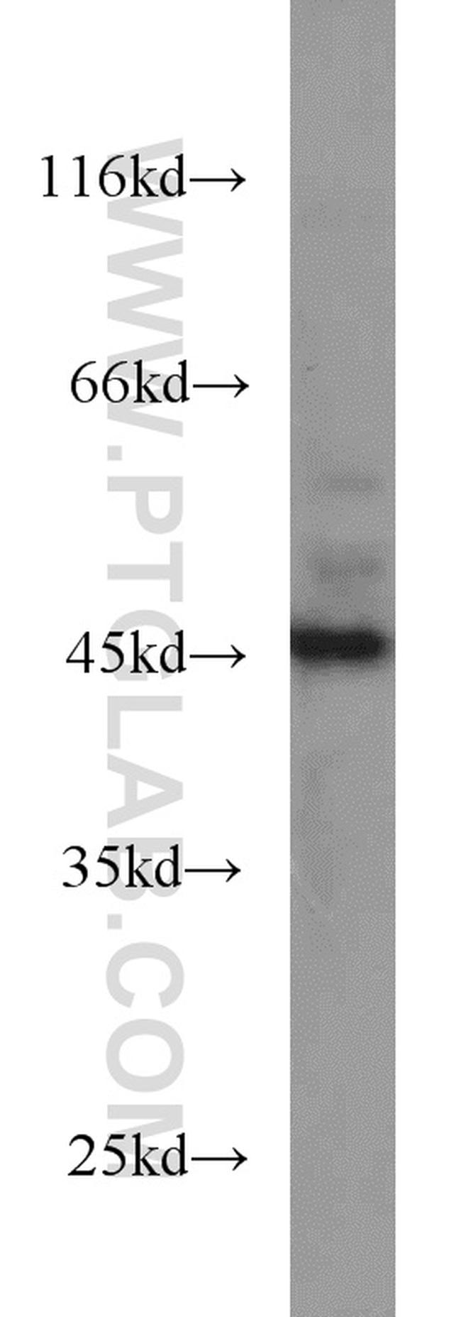 SMYD3 Antibody in Western Blot (WB)