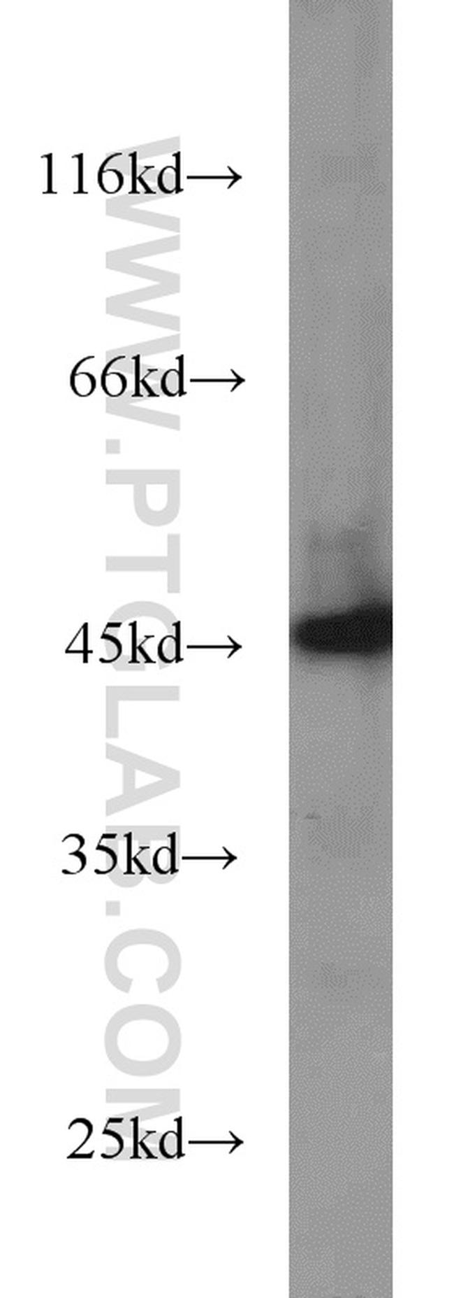 SMYD3 Antibody in Western Blot (WB)