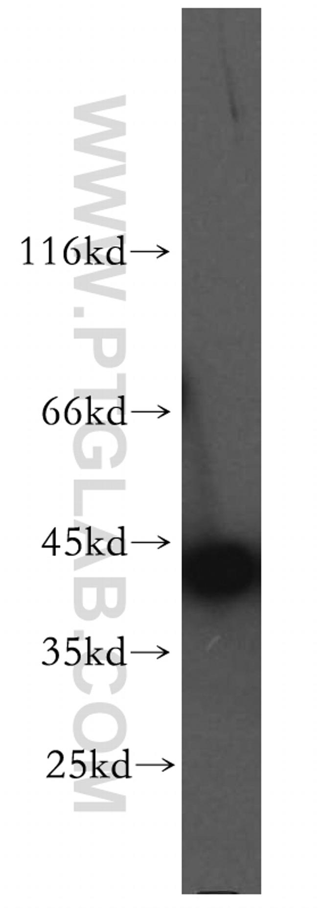 SMYD3 Antibody in Western Blot (WB)