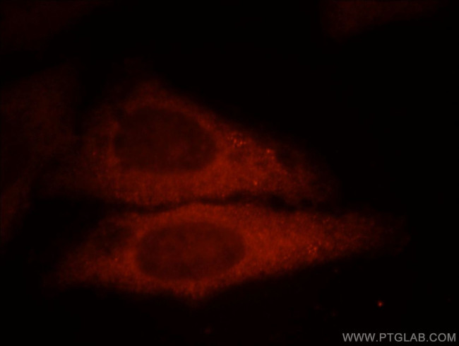 UBE2G1 Antibody in Immunocytochemistry (ICC/IF)