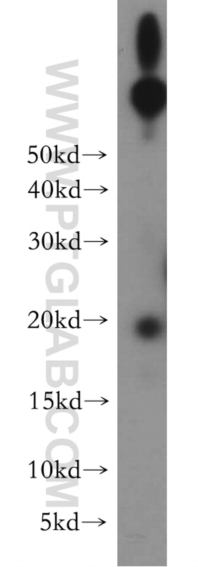 UBE2G1 Antibody in Western Blot (WB)