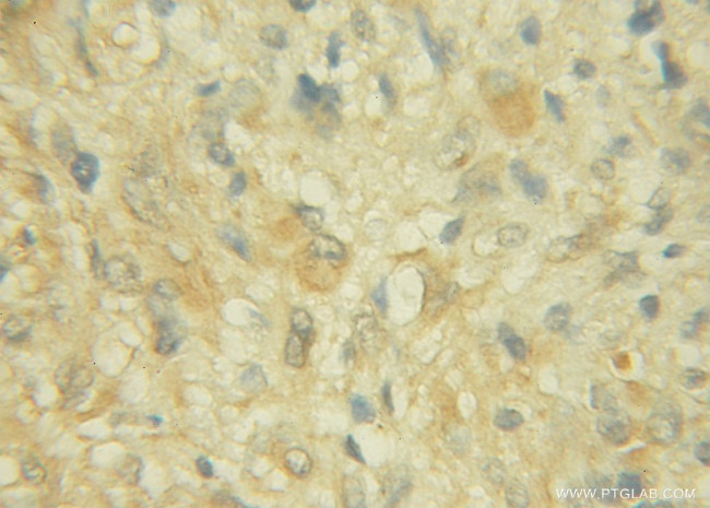 CHST10 Antibody in Immunohistochemistry (Paraffin) (IHC (P))