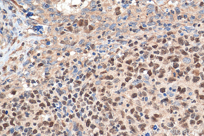 IKZF1 Antibody in Immunohistochemistry (Paraffin) (IHC (P))