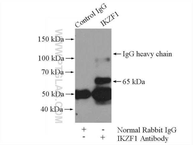 IKZF1 Antibody in Immunoprecipitation (IP)