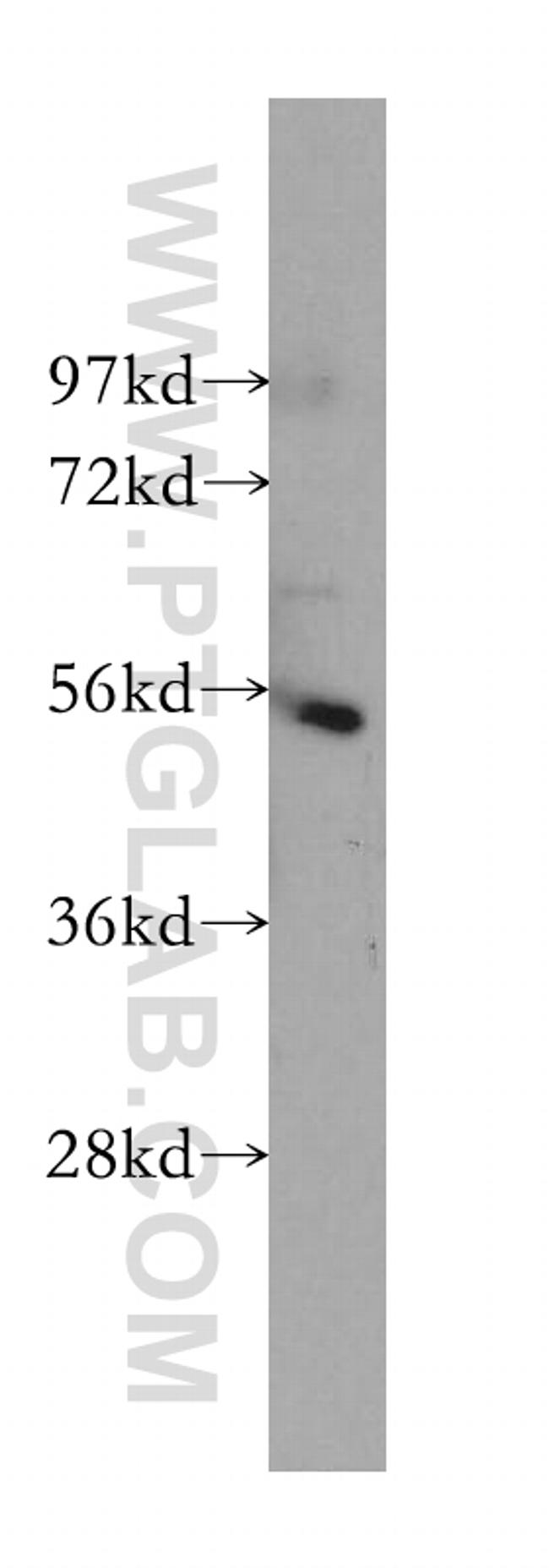 IKZF1 Antibody in Western Blot (WB)