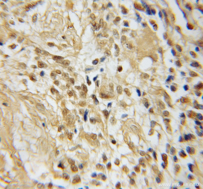 TFAP4 Antibody in Immunohistochemistry (Paraffin) (IHC (P))