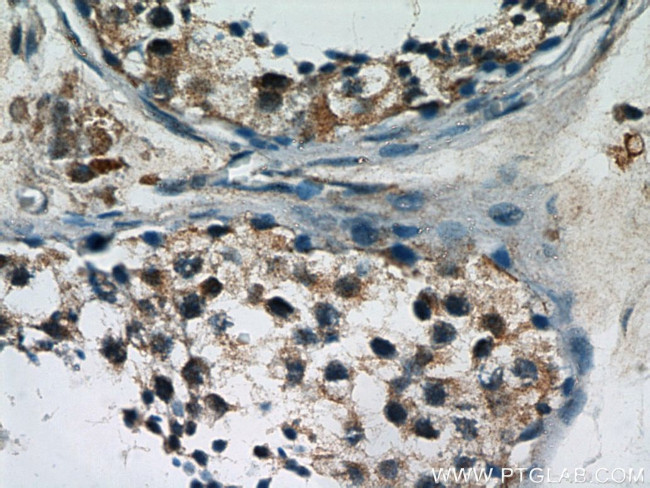 SPATA7 Antibody in Immunohistochemistry (Paraffin) (IHC (P))