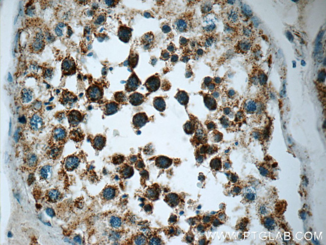 SPATA7 Antibody in Immunohistochemistry (Paraffin) (IHC (P))