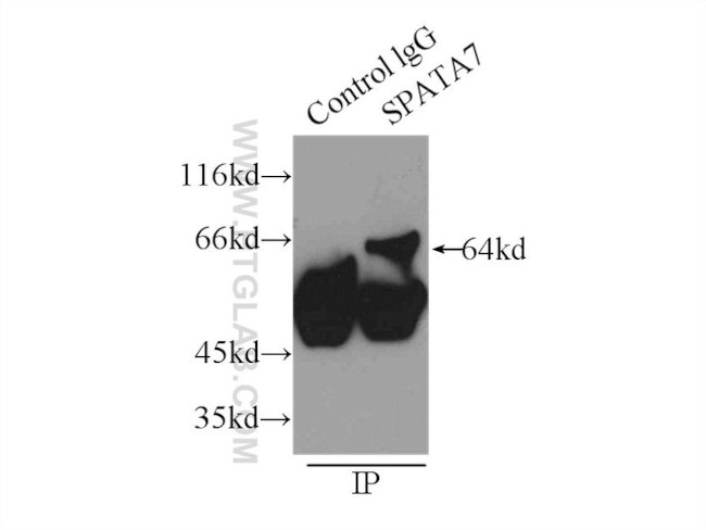 SPATA7 Antibody in Immunoprecipitation (IP)