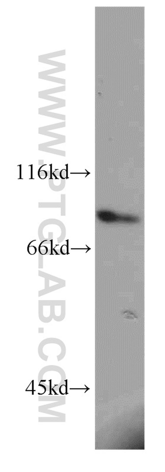 SPATA7 Antibody in Western Blot (WB)