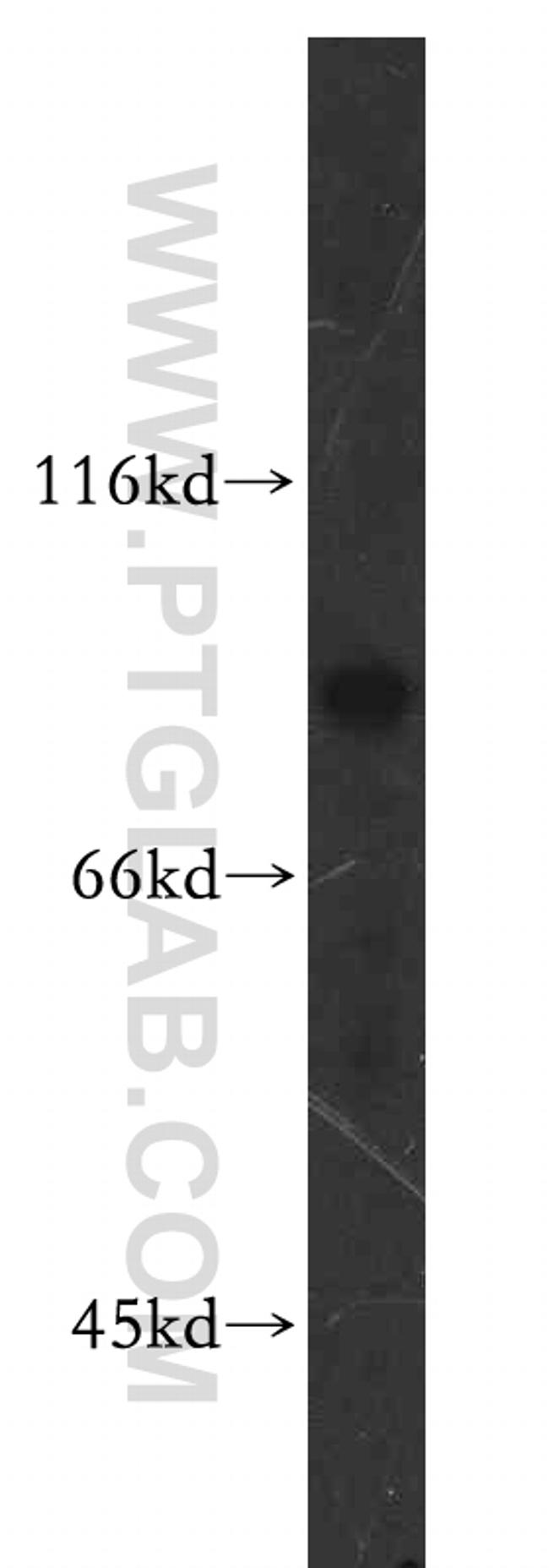 SPATA7 Antibody in Western Blot (WB)