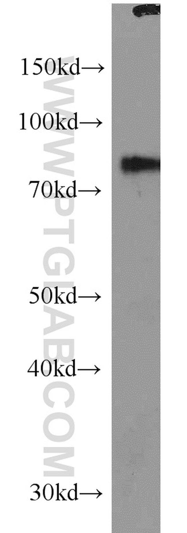 SPATA7 Antibody in Western Blot (WB)