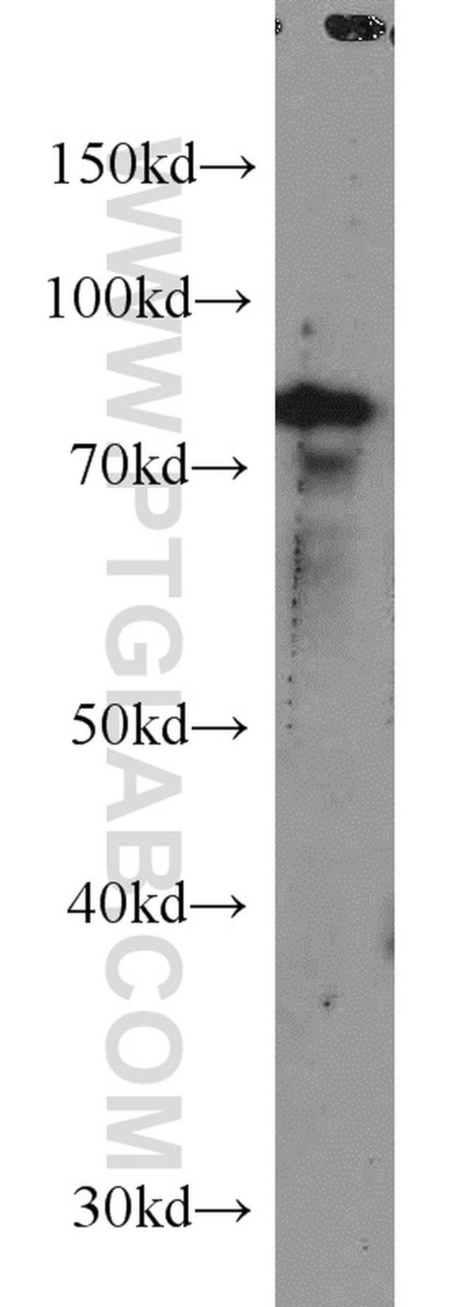 SPATA7 Antibody in Western Blot (WB)