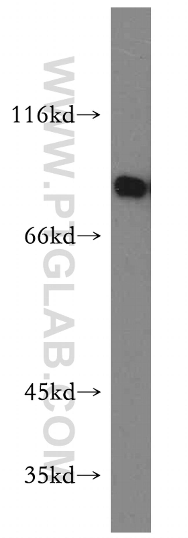 SPATA7 Antibody in Western Blot (WB)