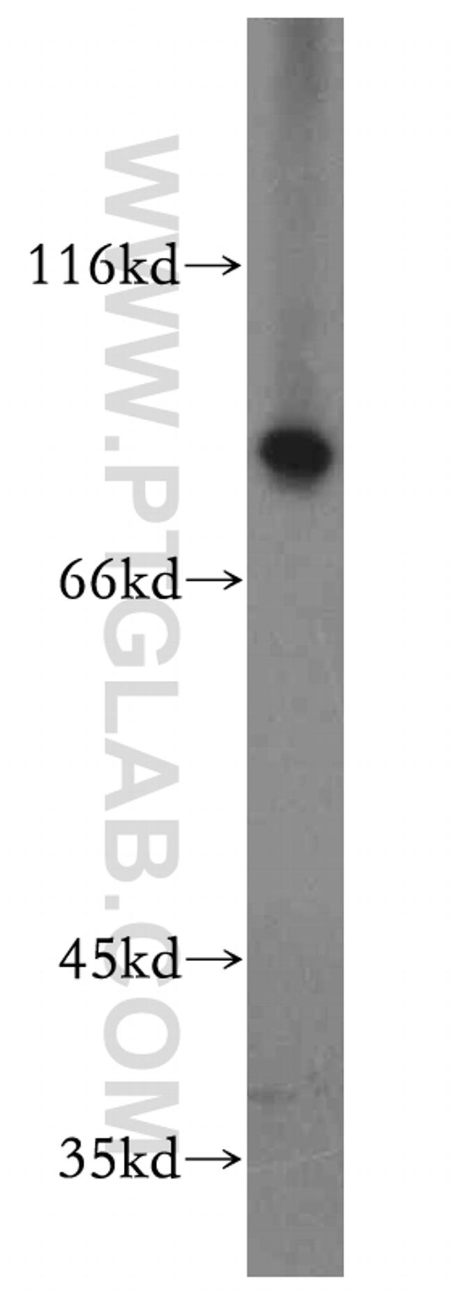 SPATA7 Antibody in Western Blot (WB)