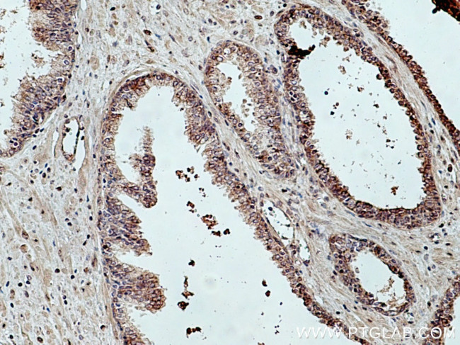 TBCE Antibody in Immunohistochemistry (Paraffin) (IHC (P))