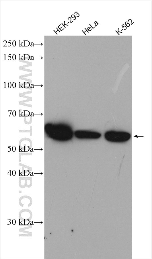 TBCE Antibody in Western Blot (WB)