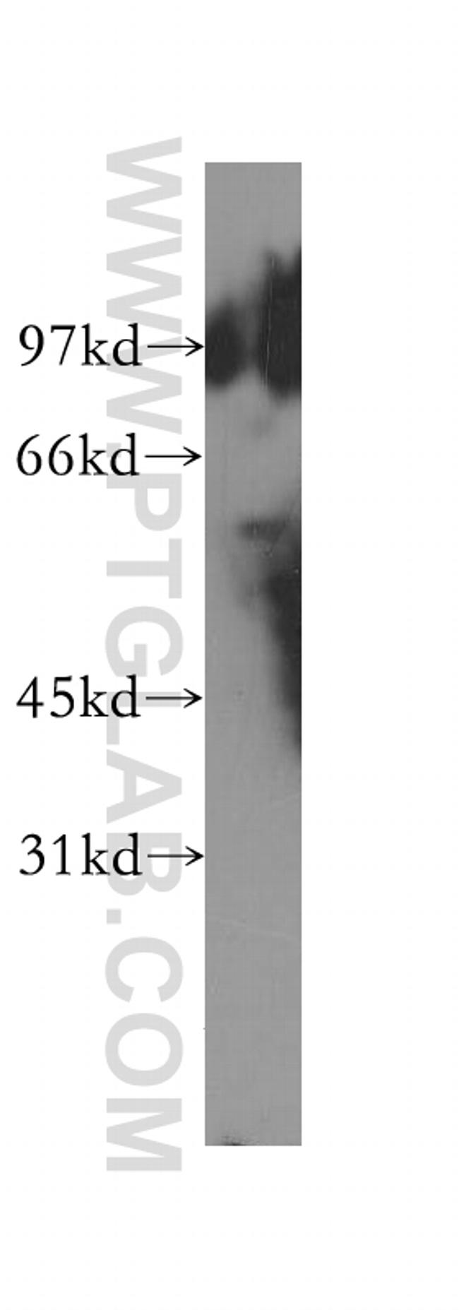 TBCE Antibody in Western Blot (WB)