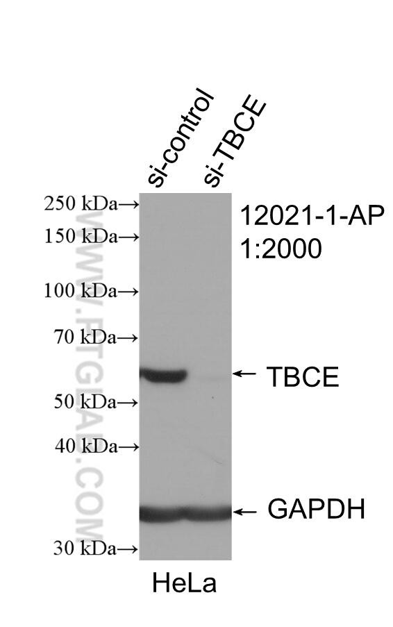 TBCE Antibody in Western Blot (WB)