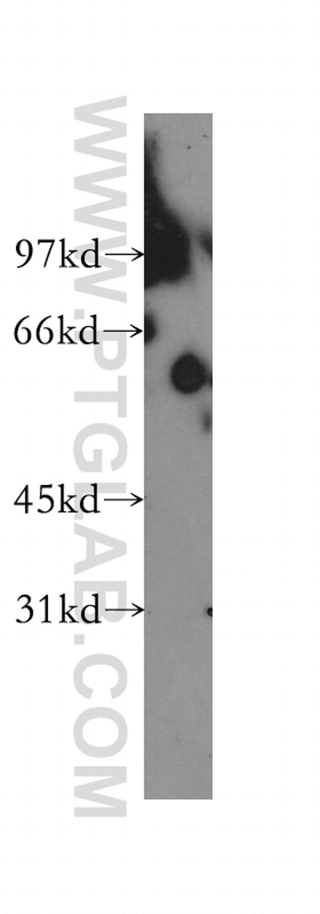 TBCE Antibody in Western Blot (WB)