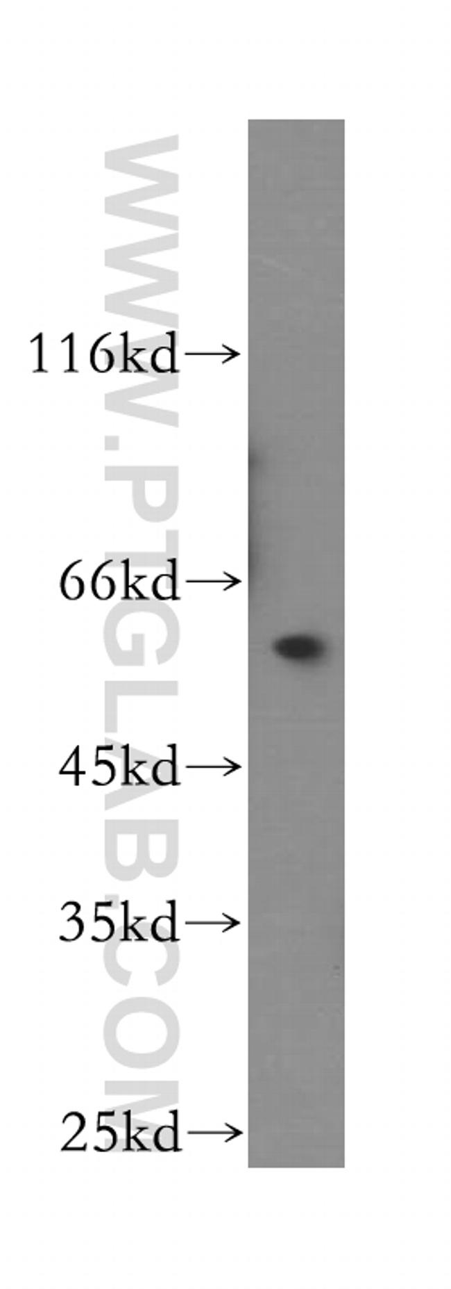 TBCE Antibody in Western Blot (WB)