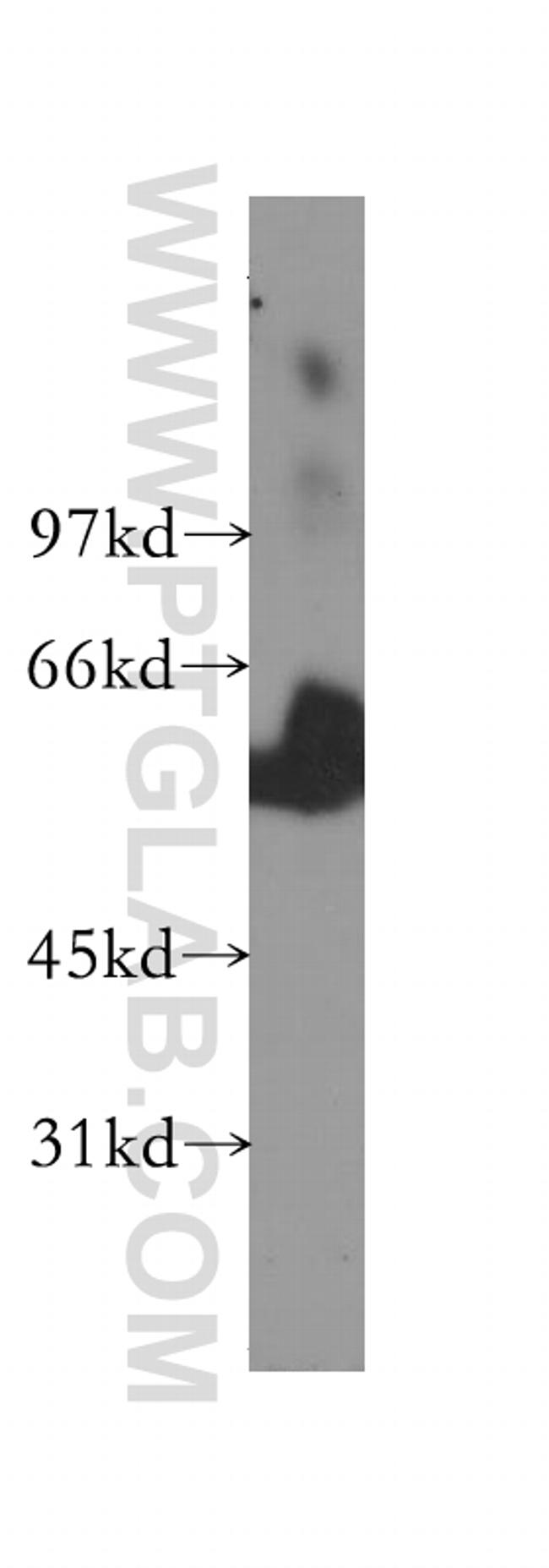 TBCE Antibody in Western Blot (WB)