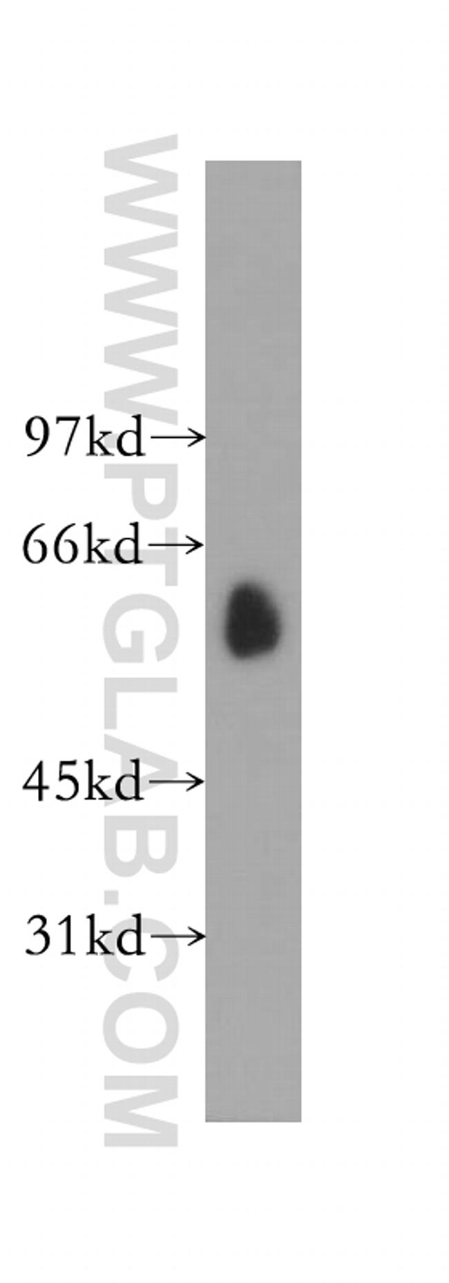 TBCE Antibody in Western Blot (WB)