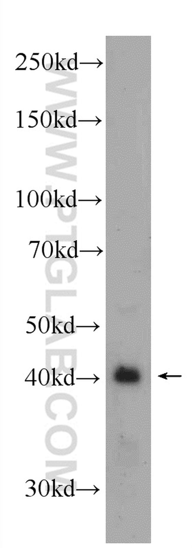 NUCKS1 Antibody in Western Blot (WB)