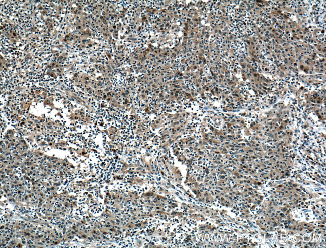 NUSAP1 Antibody in Immunohistochemistry (Paraffin) (IHC (P))