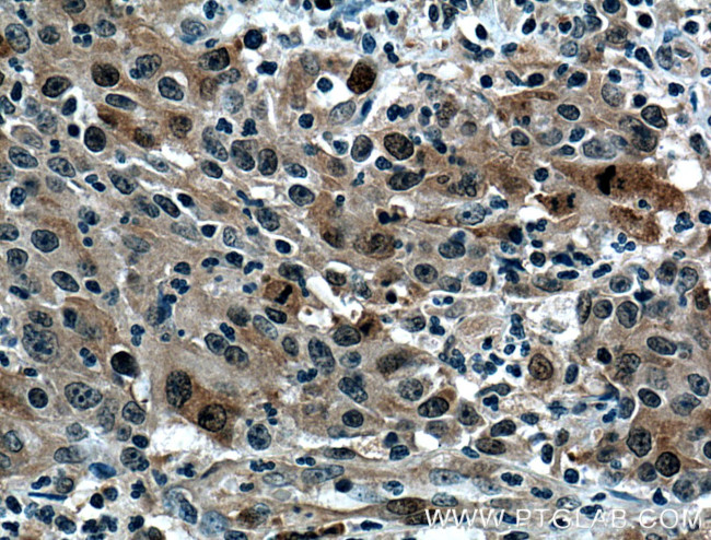 NUSAP1 Antibody in Immunohistochemistry (Paraffin) (IHC (P))