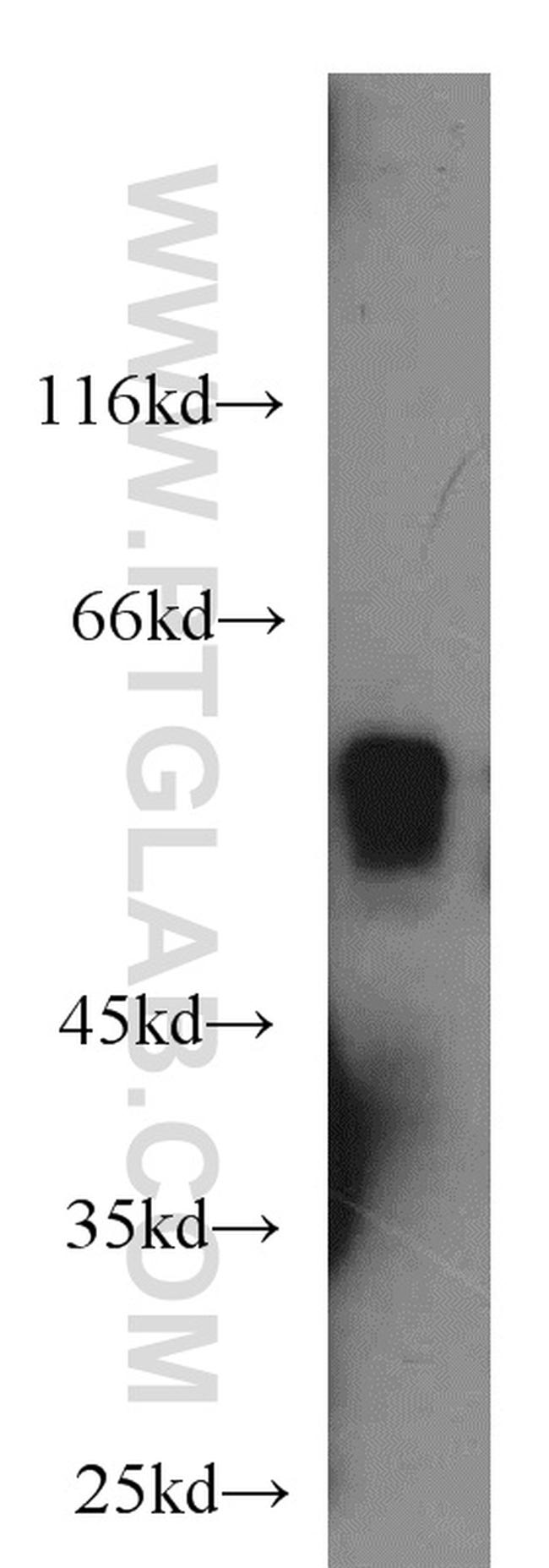 NUSAP1 Antibody in Western Blot (WB)