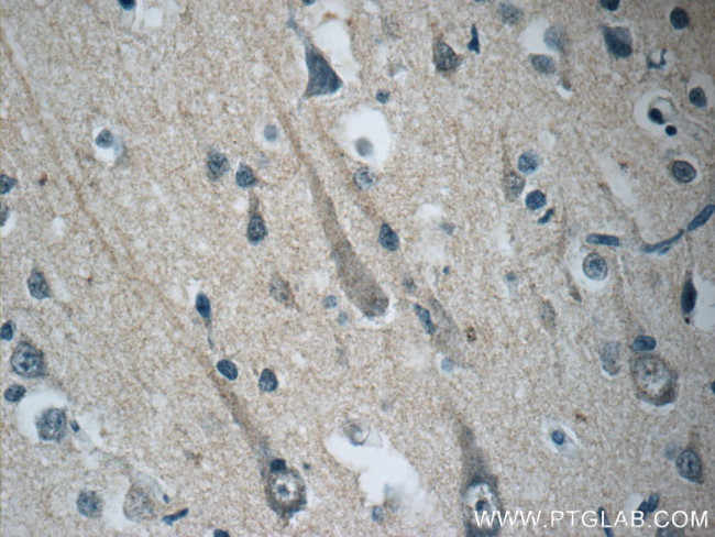 STMN4 Antibody in Immunohistochemistry (Paraffin) (IHC (P))