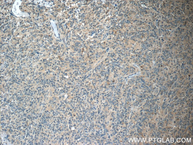 STMN4 Antibody in Immunohistochemistry (Paraffin) (IHC (P))