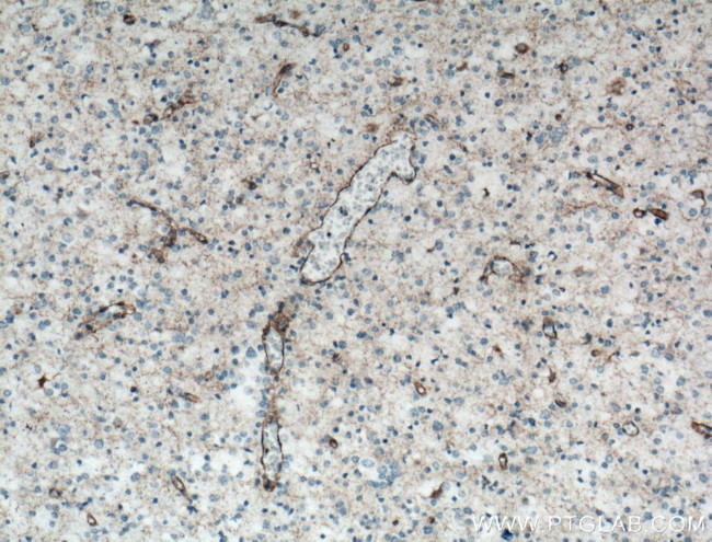 STMN4 Antibody in Immunohistochemistry (Paraffin) (IHC (P))