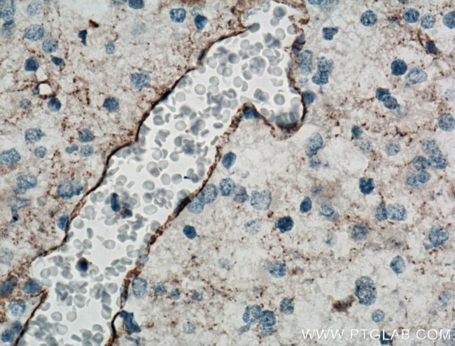 STMN4 Antibody in Immunohistochemistry (Paraffin) (IHC (P))