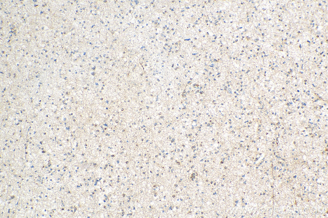 STMN4 Antibody in Immunohistochemistry (Paraffin) (IHC (P))