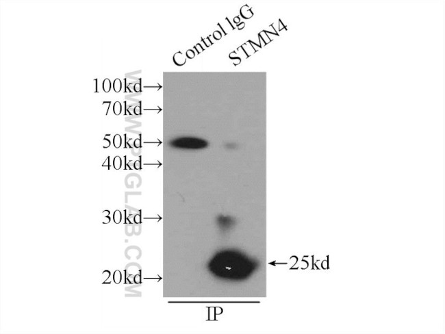 STMN4 Antibody in Immunoprecipitation (IP)