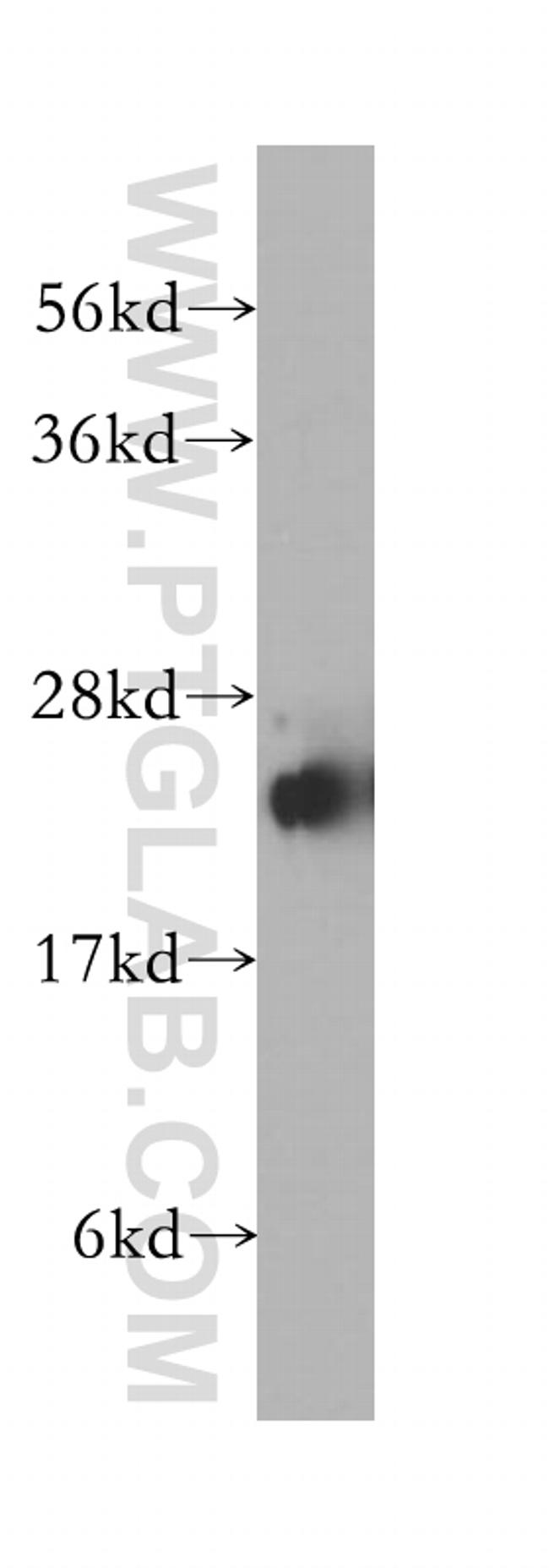 STMN4 Antibody in Western Blot (WB)