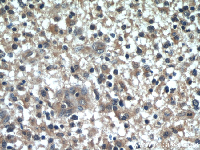 WBP2 Antibody in Immunohistochemistry (Paraffin) (IHC (P))