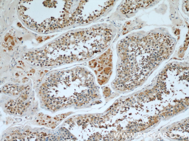 WBP2 Antibody in Immunohistochemistry (Paraffin) (IHC (P))