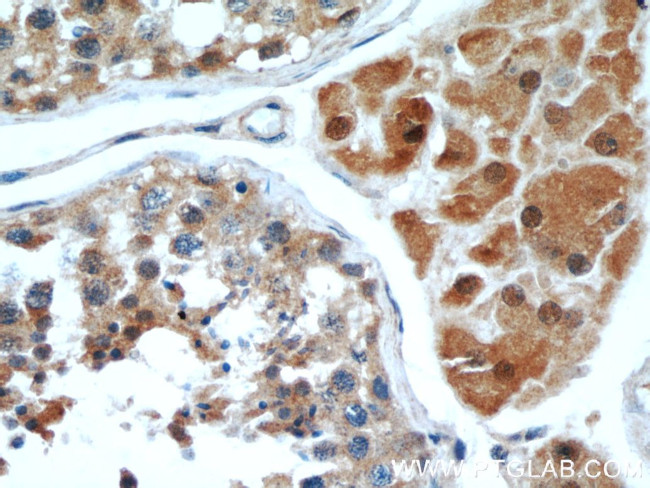 WBP2 Antibody in Immunohistochemistry (Paraffin) (IHC (P))