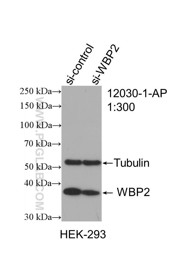 WBP2 Antibody in Western Blot (WB)