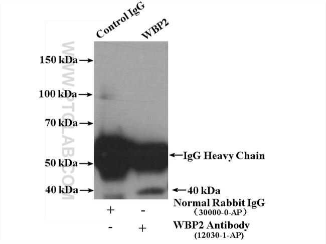 WBP2 Antibody in Western Blot (WB)