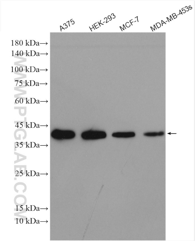 WBP2 Antibody in Western Blot (WB)