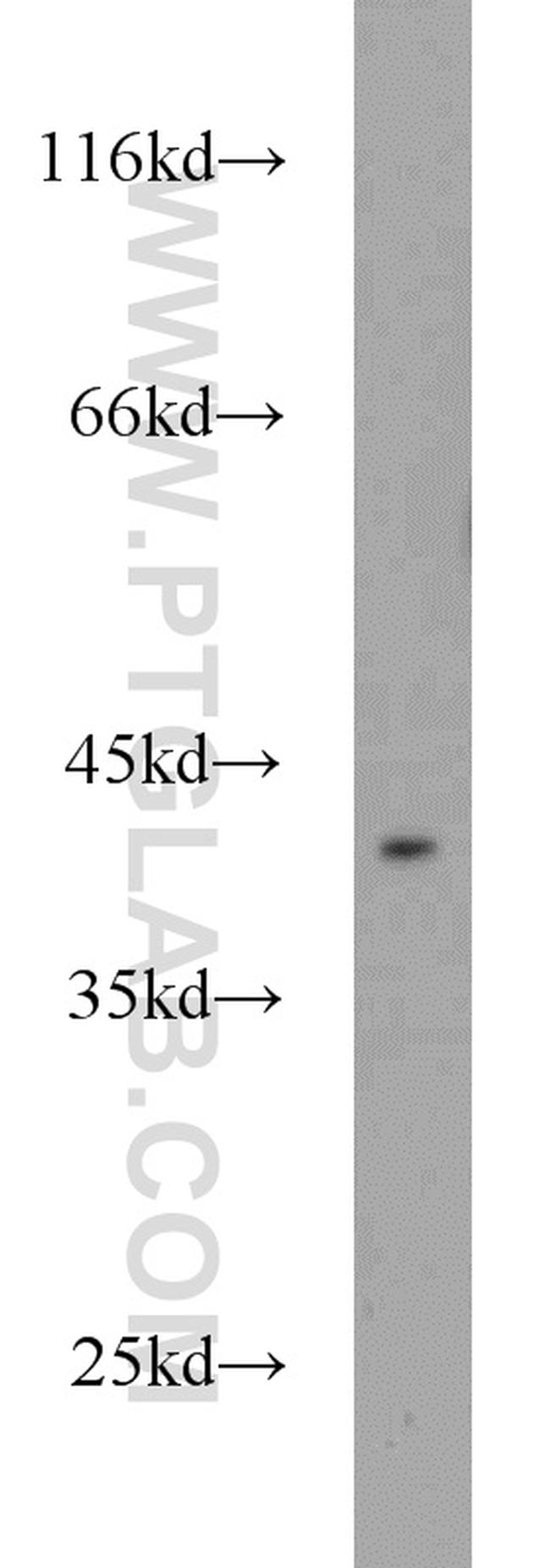 WBP2 Antibody in Western Blot (WB)